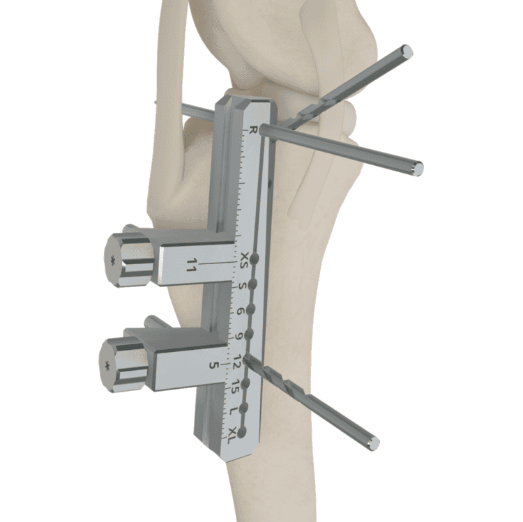 Guided TTA and Meniscus